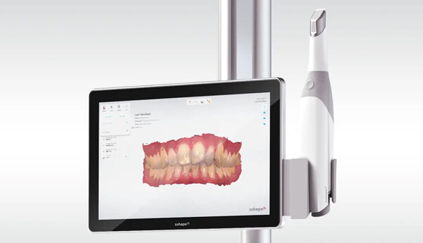 Intra-orale scanner: 3D scan van de mond